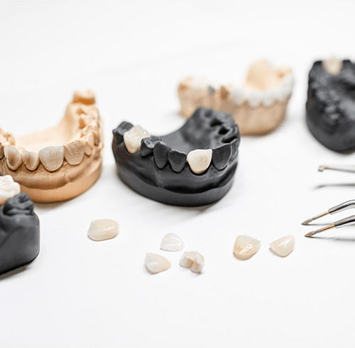Dental Crowns in Fort St. John (FSJ), BC