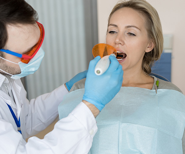 cavity fillings in fsj