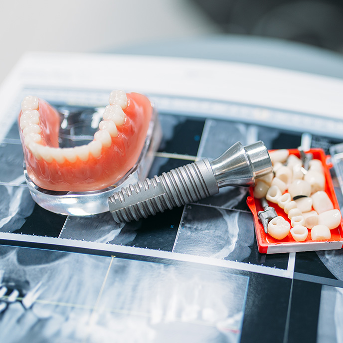 Full & Partial Dentures in Fort St. John — At Greenwoods Dental Clinic ✅