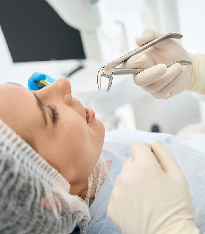 tooth-extraction-in-fsj tooth extraction in fsj